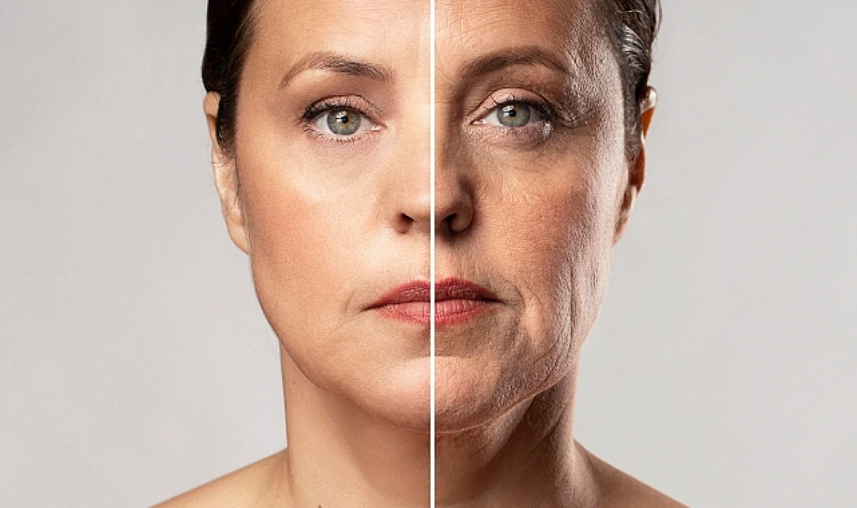 Y&uuml;z Germe Ameliyatı Nedir? Gen&ccedil;leşme &Uuml;zerindeki Etkisi